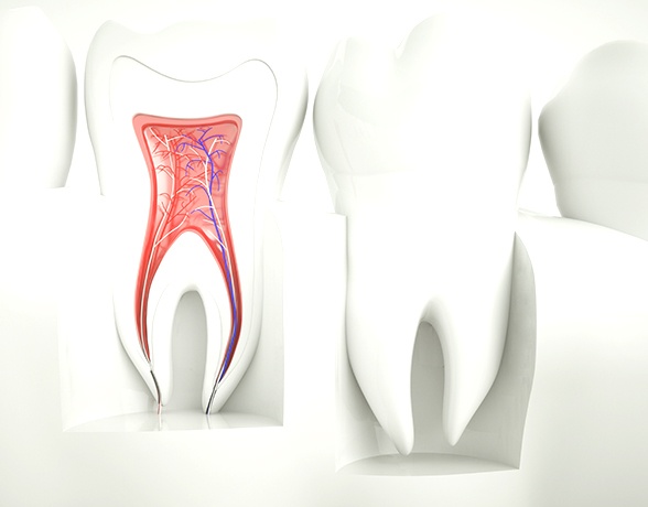 Animated smile befor root canal therapy