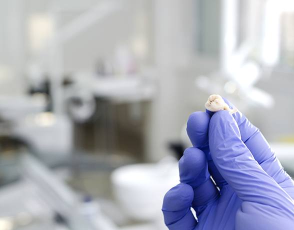 Dentist holding a tooth after extraction