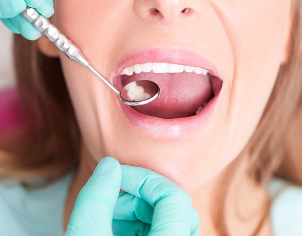 Closeup of patient during dental checkup and teeth cleaning visit