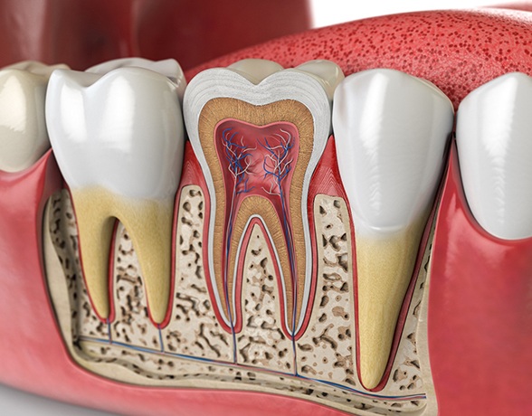 an illustration of a root canal in Grand Prairie