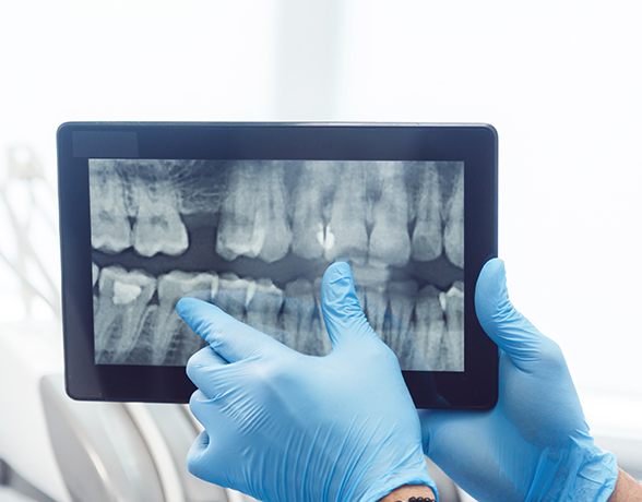 Dentist looking at Dexis digital x-rays on tablet computer