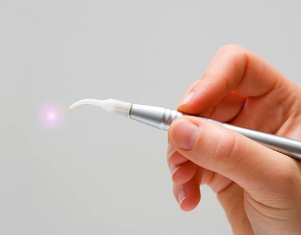 Hand holding a soft tissue laser dentistry tool