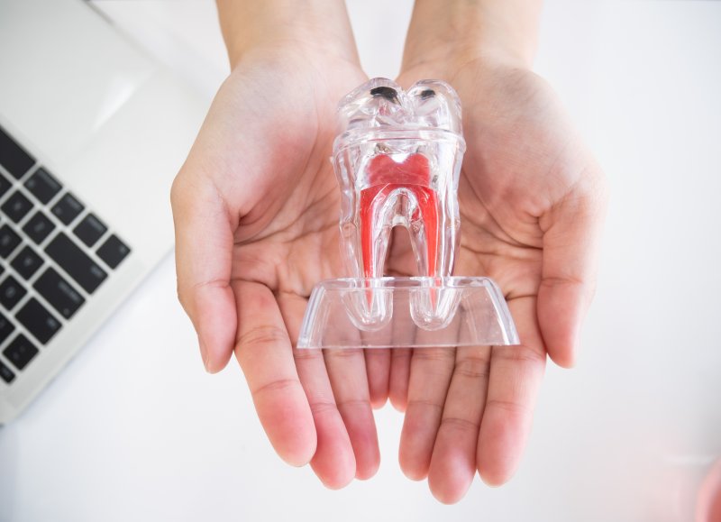 A model depicting a root canal treatment held in a dentist's hands